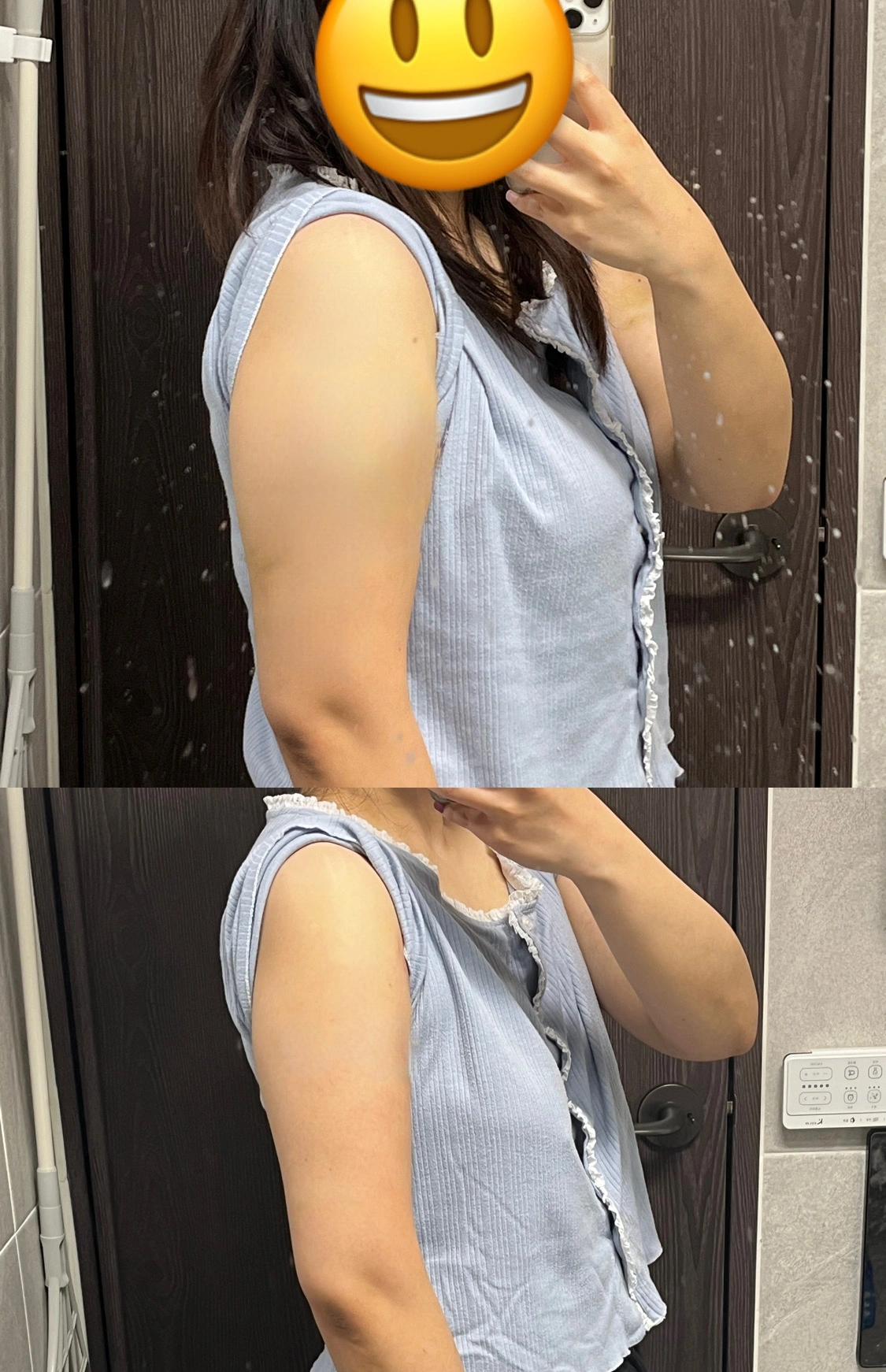 바디라인 케어 관리 전