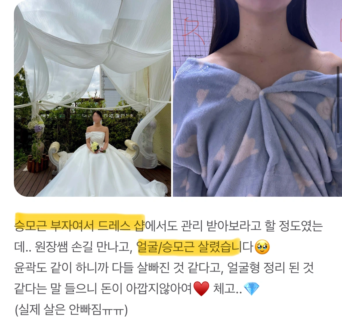 웨디아 여수웅천점 관리 후기 2